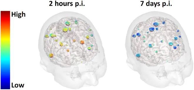 大脑|脑科学日报：性别对大脑的影响；疼痛定义40年来首次修订