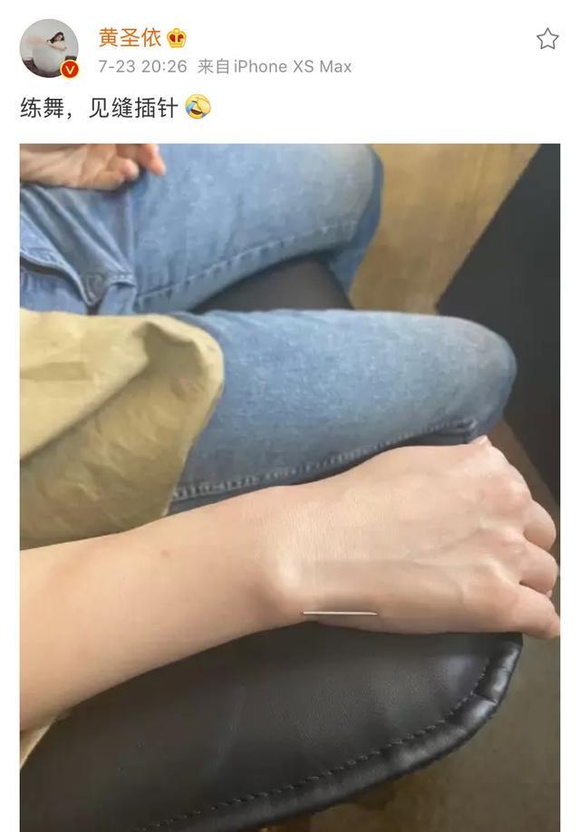 黄圣依|豪门少奶奶太拼！黄圣依练舞过度手扎银针，身体吃不消疑似累病