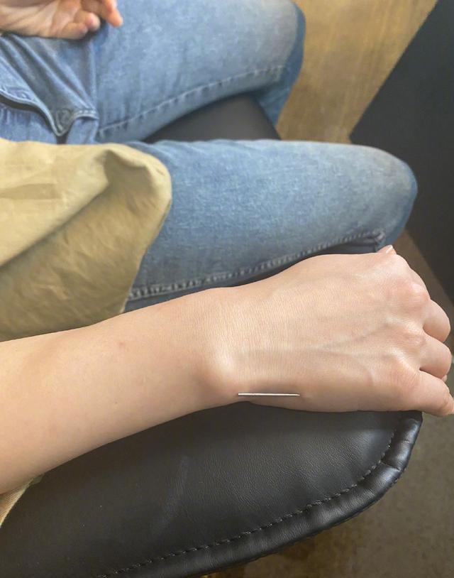 黄圣依|豪门少奶奶太拼！黄圣依练舞过度手扎银针，身体吃不消疑似累病