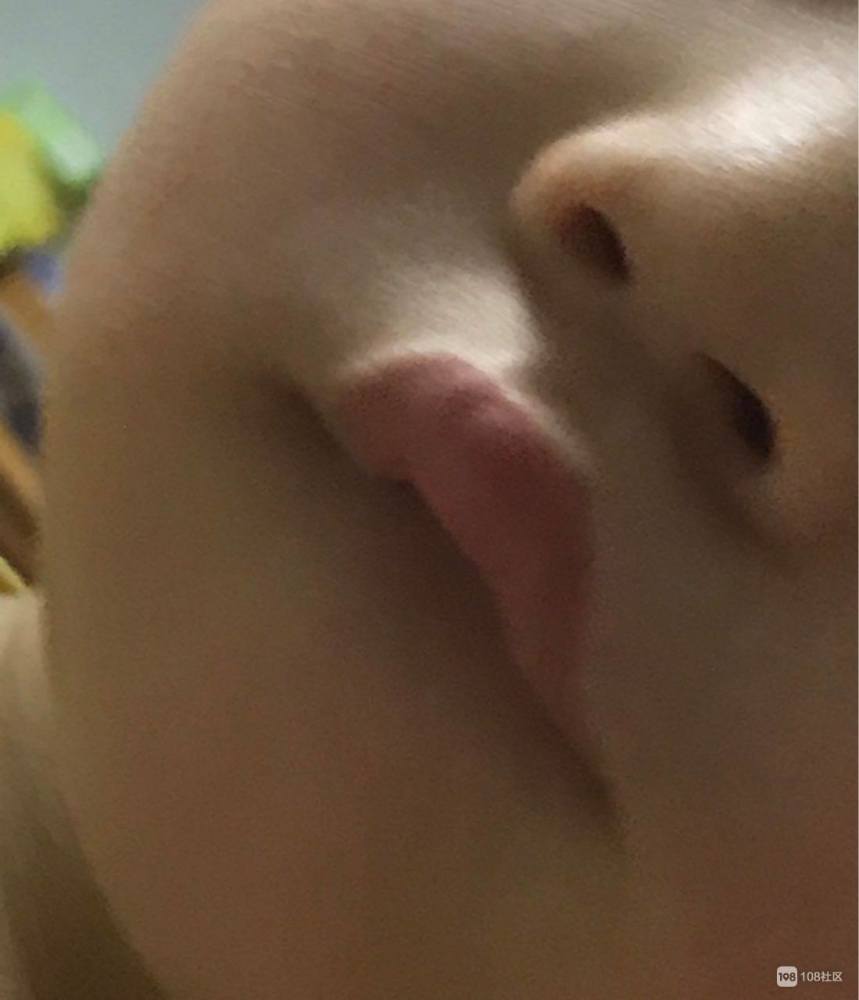 怎样制止小孩咬下嘴唇