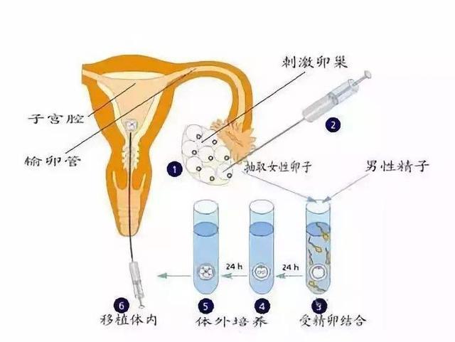 巴厘岛试管价格→滔滔顾问领导者的简单介绍-第2张图片-鲸幼网