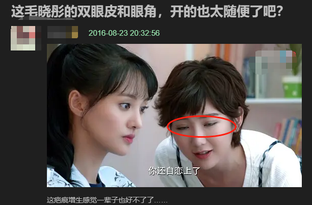 毛晓彤|毛晓彤被曝整容？Baby化妆师吐槽她整容医生不行，眼角开口出现后遗症