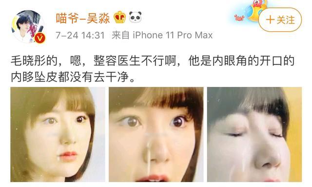 毛晓彤|baby前化妆师内涵毛晓彤整容？直言其手术太失败
