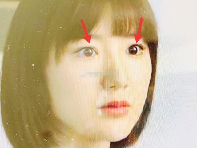 毛晓彤|baby前化妆师内涵毛晓彤整容？直言其手术太失败