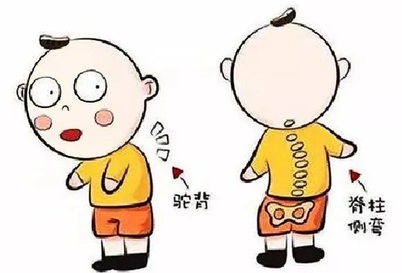 孩子弯腰驼背,高低肩?可能是患上……_腾讯新闻