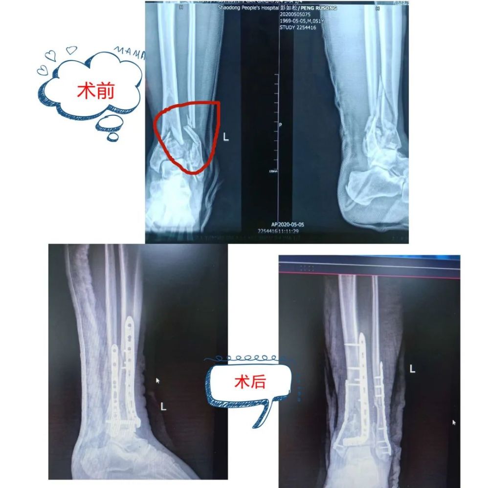 惊险 邵东一男子从9楼不慎摔下 结果 腾讯新闻