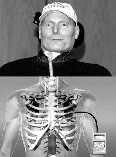 超人坠马重伤全身瘫痪坐轮椅演戏9年后即将站起却意外离世