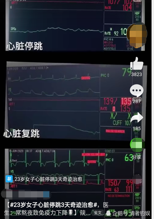 生命奇迹 23岁女子心脏停跳3天奇迹治愈 医生 常熬夜引起的 腾讯网