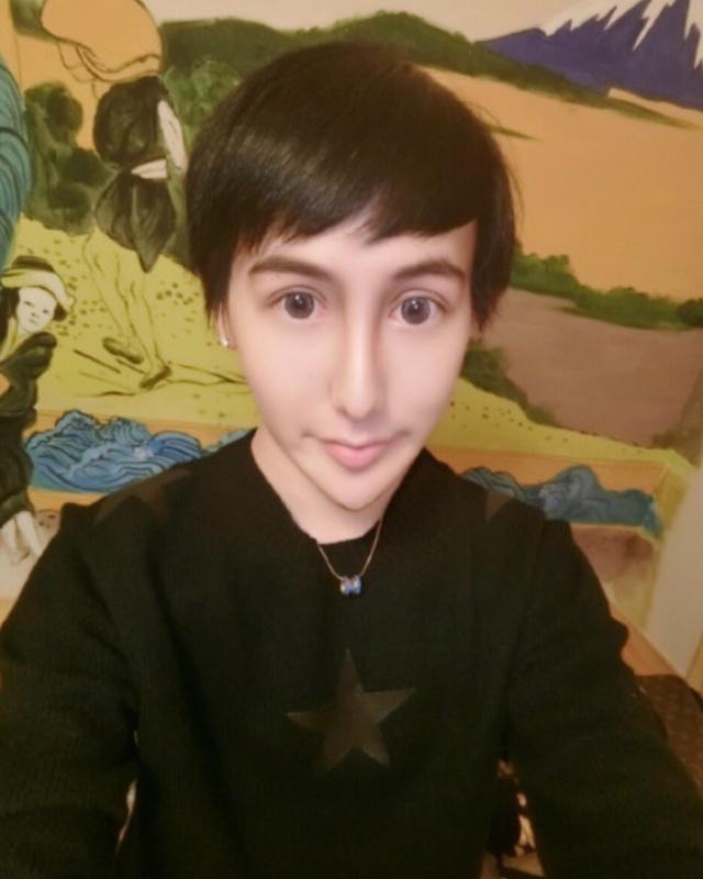 还记得蛇精脸刘梓晨吗面部填充大变样如今让人认不出