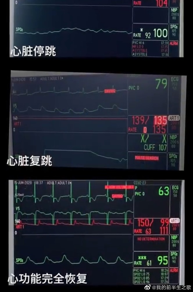 23岁女子心脏停跳3天奇迹治愈 腾讯新闻