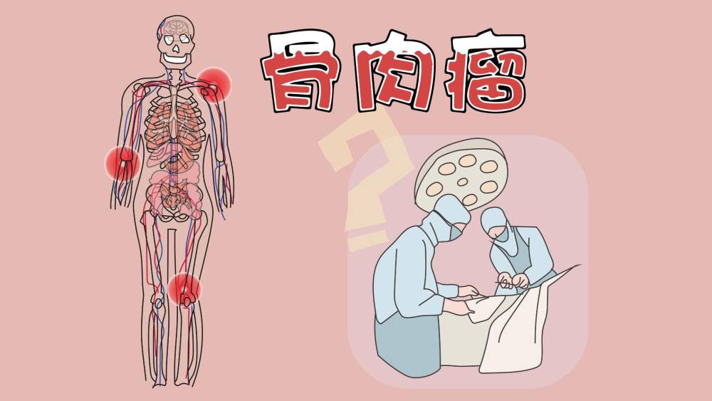 这是一种指原发于骨内的高恶性肿瘤,其基本特征是增殖的肿瘤细胞直接