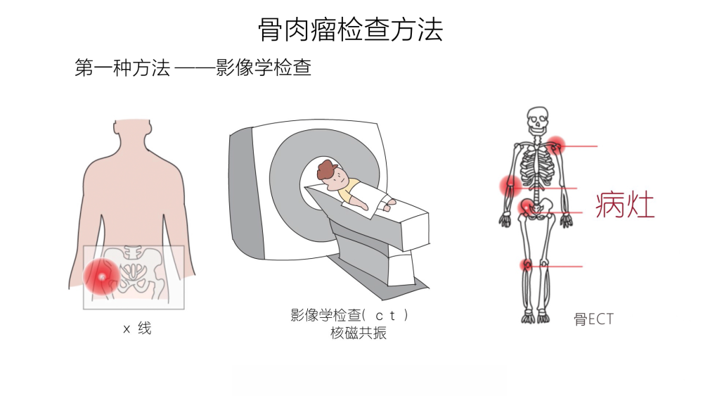 随着医疗水平的不断上升,恶性肿瘤也是可能被治愈的.