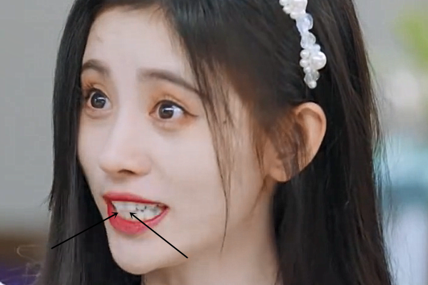 鞠婧祎和杨迪飙演技,因表情夸张口红粘牙上,苦心经营的人设白搭