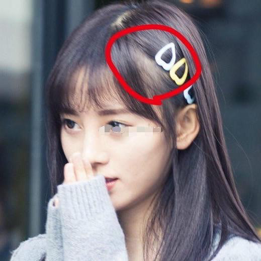 鞠婧祎新自拍暴露真实发量两鬓头发稀疏发际线粉涂太多很明显