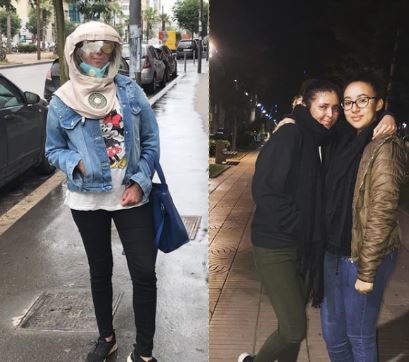 过敏|女孩对阳光过敏 20多年来只要出门就得戴太空面罩