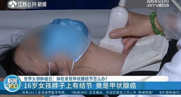 16岁女孩脖子上有结节竟是甲状腺癌
