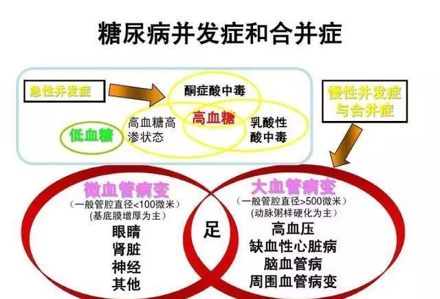 糖尿病多久会出现并发症 腾讯新闻