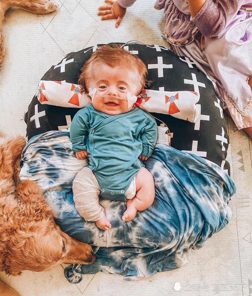 孩子|一抱就碎的婴儿：“玻璃王子”艰难挺过4个月