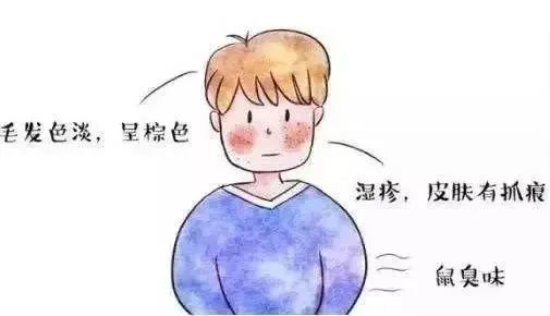 医生|医生对你说 TMD，真的不是在骂人……