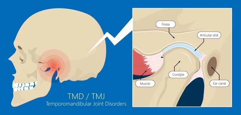 医生|医生对你说 TMD，真的不是在骂人……