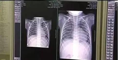 说明书|家用加湿器也杀人？！韩1.4万人按照说明书使用，却因此死亡