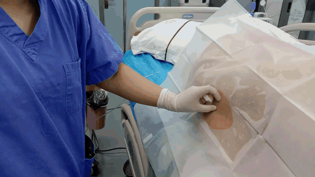 一根细针背后的故事,没想到是这样的无痛分娩