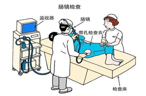 医生有必要做胃镜肠镜检查吗