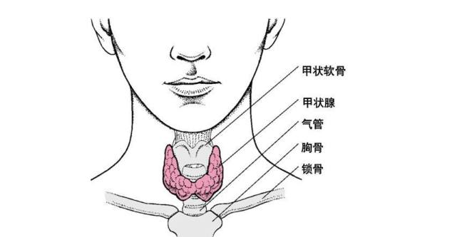 亚急性甲状腺炎的结节根据患病部位的大小而定,一般此类的结节质地