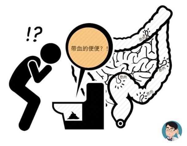 为何肠癌趋势年轻化?医生忠告:符合这6种