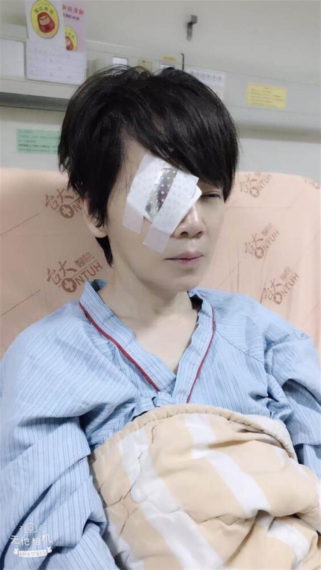突发意外53岁女星直播视网膜突然脱落一只眼睛完全失明看不见