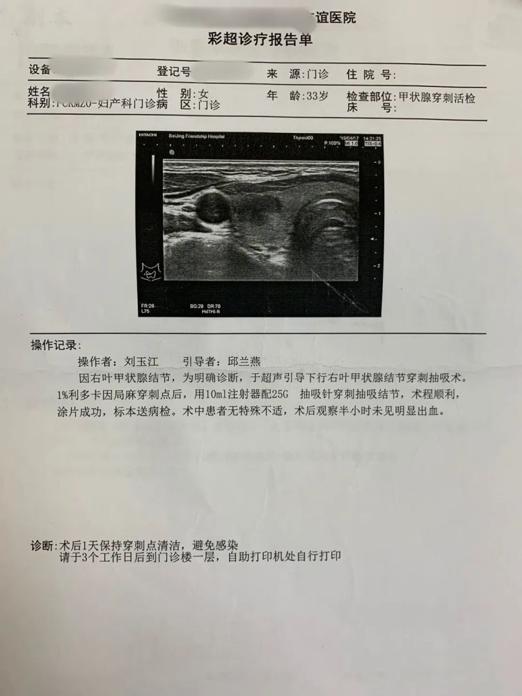 甲状腺腺瘤彩超图片图片