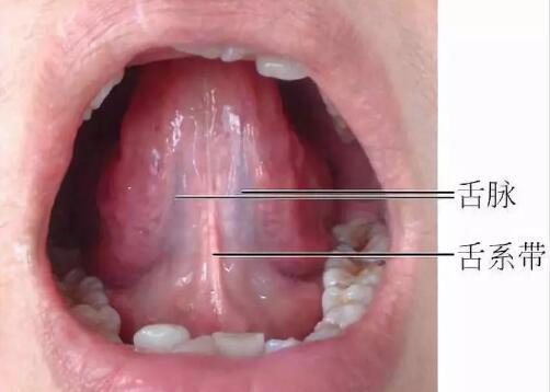正常人的舌下静脉图片图片