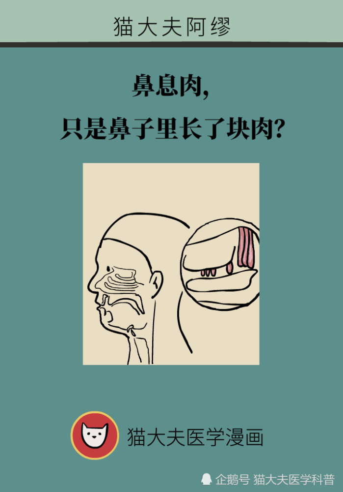 鼻息肉|鼻息肉，只是鼻子里长了块肉？
