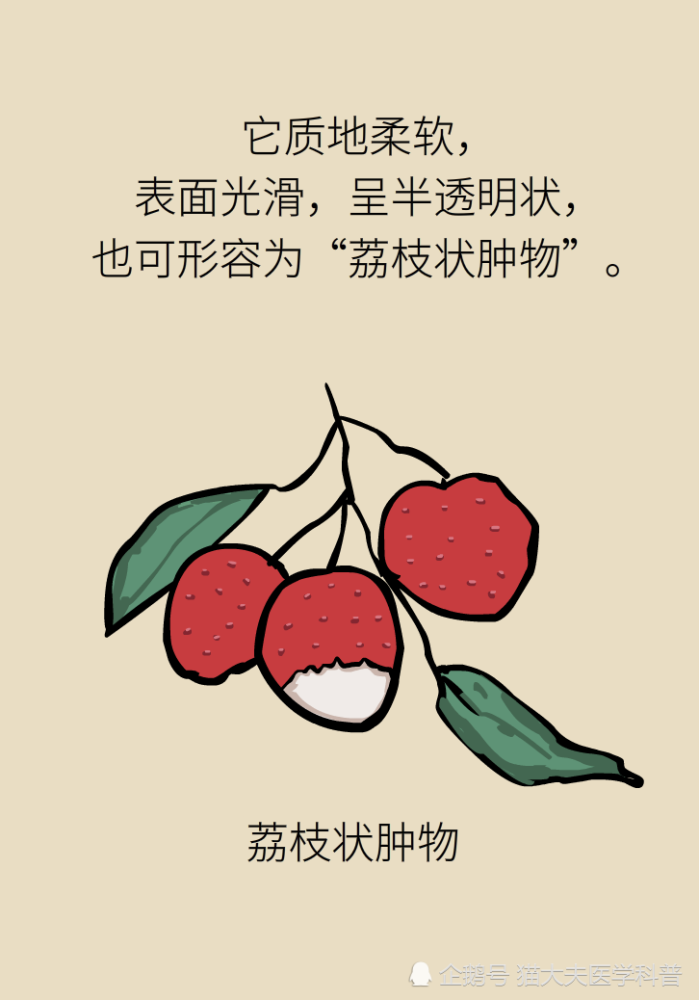 鼻息肉|鼻息肉，只是鼻子里长了块肉？