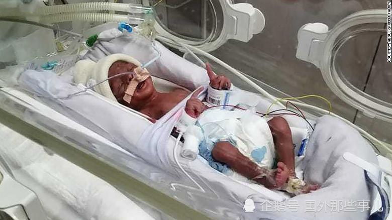 蒂亚尼|女子生下四胞胎没钱付医疗费，富豪看新闻后慷慨为其支付76万账单