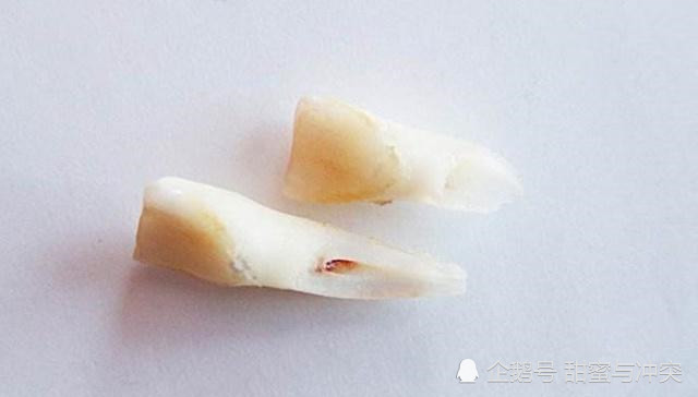 孩子乳牙掉了别扔,存下来能救命,是真的吗专家说出真相