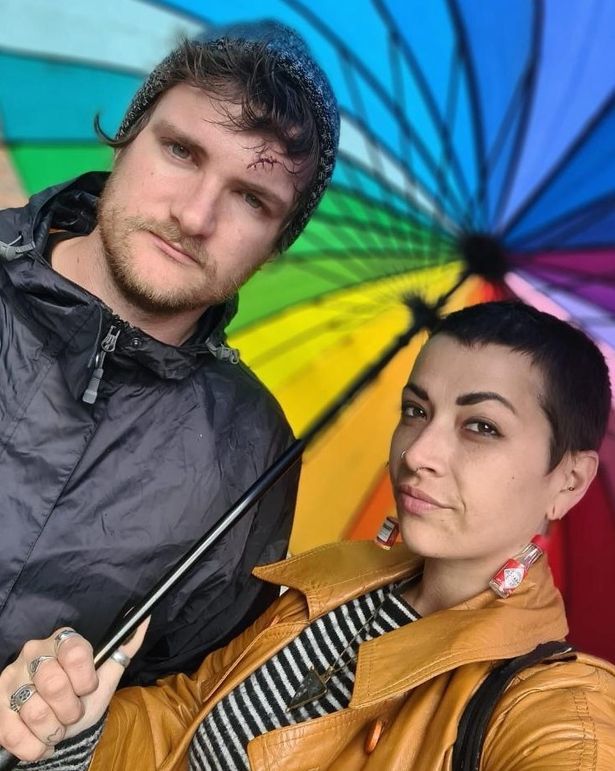 英国_社会|英国夫妇因一句随口夸奖被一群孩子追打，头部连缝数针大呼可怕