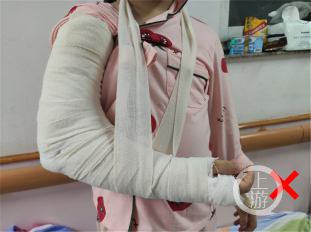 第二天就又痛又肿|重医儿童医院|石膏固定