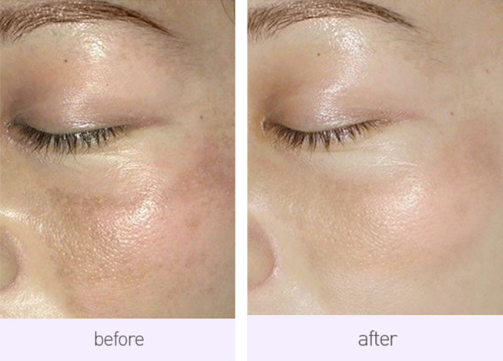 这个秘方,堪称抹在皮肤上的美白针!