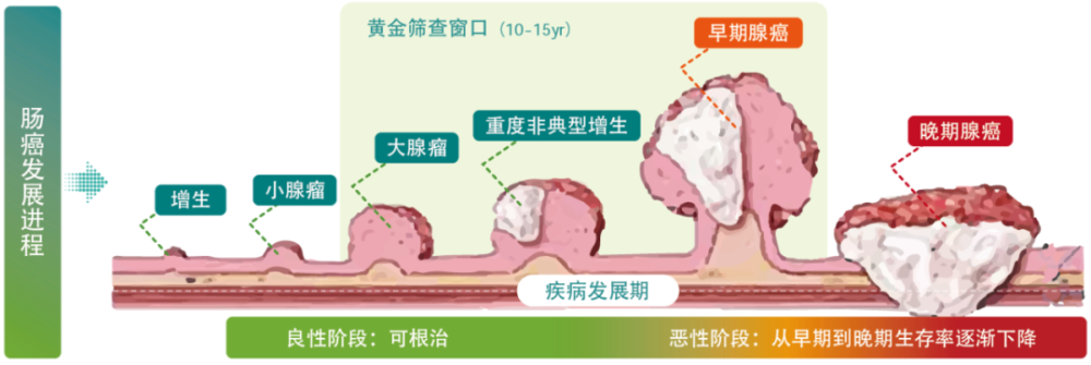 痔瘡和腸癌傻傻分不清!請把這張