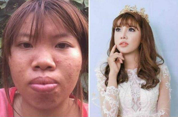 靠谱!越南代妈"乍暖还寒"-第2张图片-规培博客