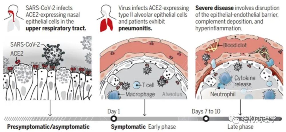 新冠病毒|Science：新冠病毒是如何导致新冠肺炎的