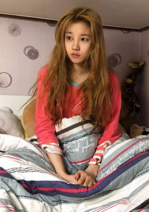 别再说宋雨琦"整容"了?童年照被"疯传"后,整没整容一目了然