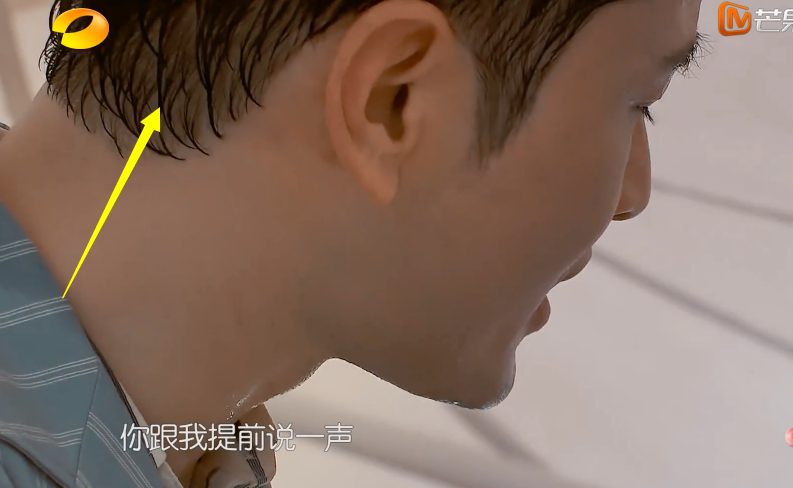 黄晓明出汗太猛彻底"脱妆",后脑勺稀疏一大片,发量引发网友们担忧!