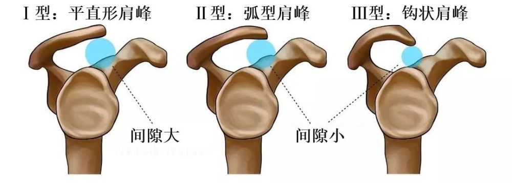 流水不腐户枢不蠹我的肩最终还是蠹了