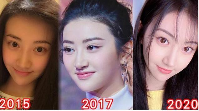 32岁景甜开直播变话痨大方承认整容坦言抑郁了很久每天都想哭