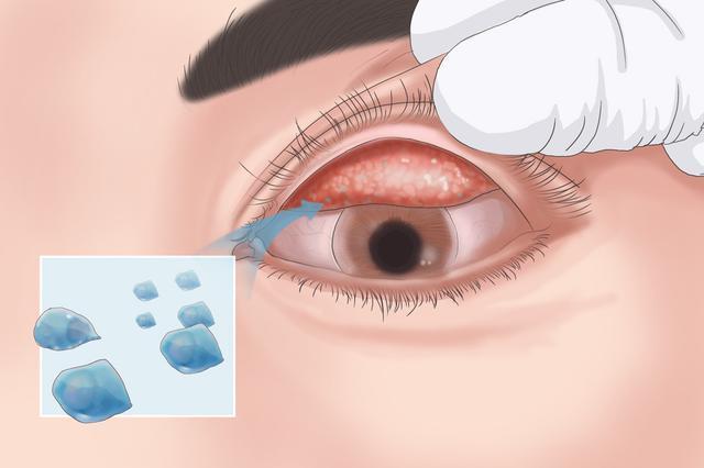 衣原体|中国衣原体之父，拯救过无数人，却自缢身亡，与诺贝尔奖失之交臂