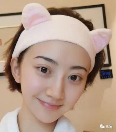 景甜大方说自己do了!做埋线双眼皮结果做成悲伤蛙