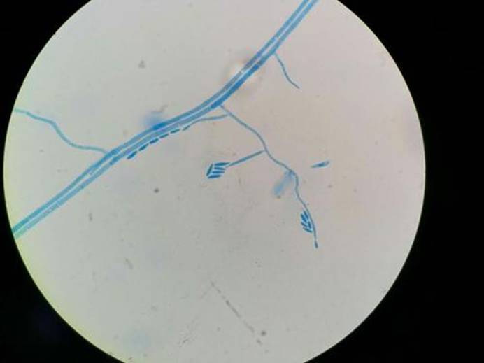 癌症|农作物也会患“癌症”，一旦被这种真菌感染，植物将无可救药