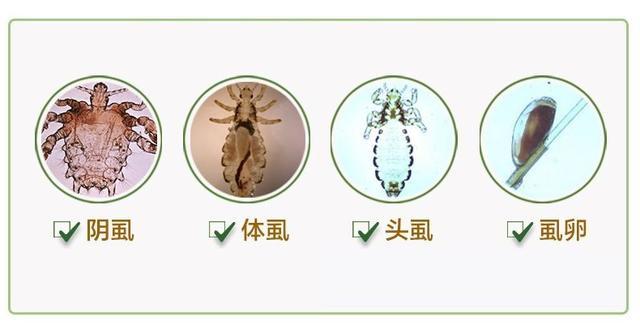 其实虱子的种类很多,人体和哺乳类动物身上都有大量寄生,不过本文主要